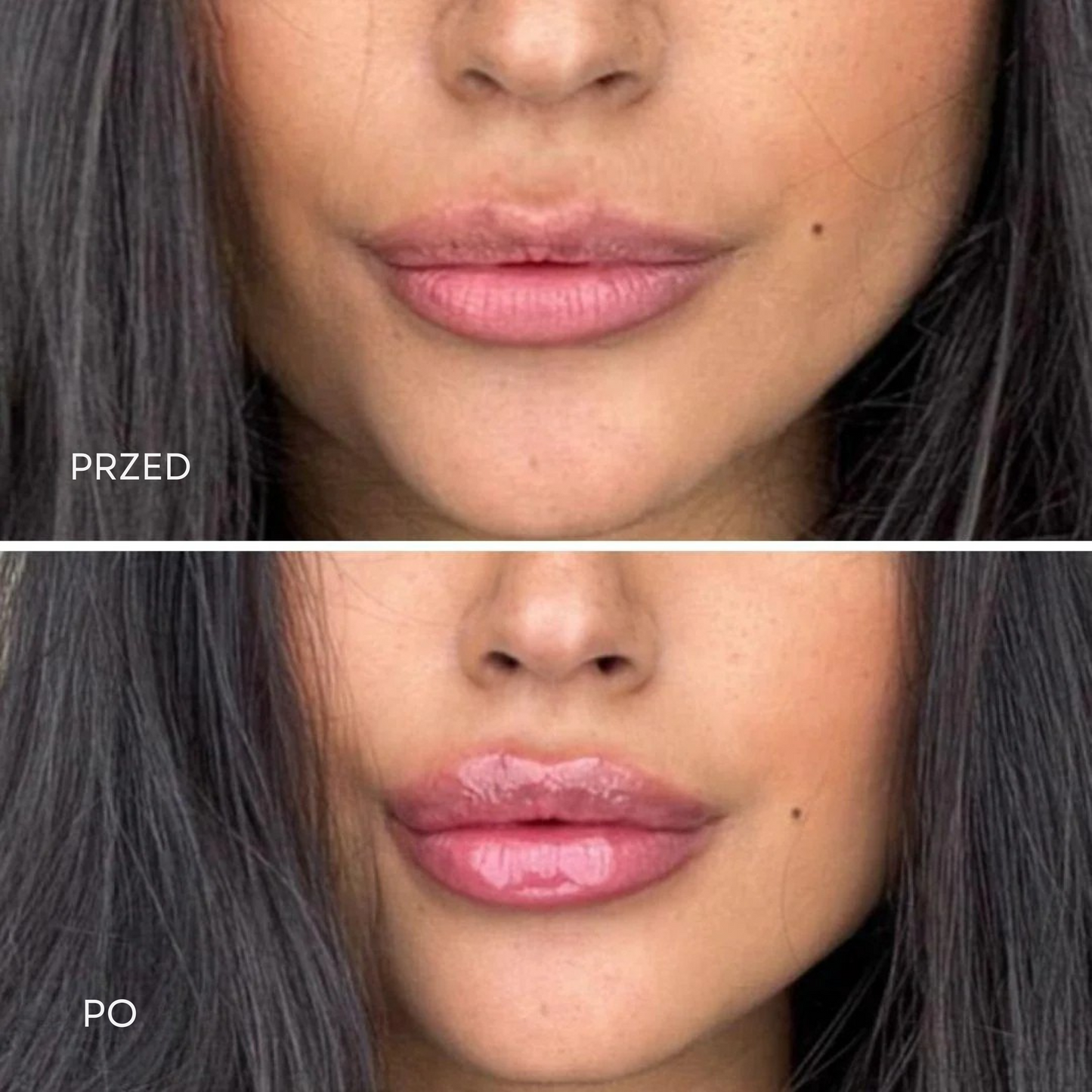 Reviderma Lip Plumper